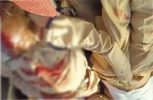 पुलिसकर्मी की मौत, सड़क हादसे में आई थी गंभीर चोट Chhattisgarh Crimes