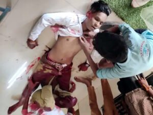 रायगढ़ के सरकारी स्कूल में इंटरवल के दौरान दो लड़कों ने छात्र के पेट में मारा चाकू; प्रेमप्रसंग में हत्या की आशंका Chhattisgarh Crimes