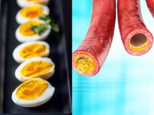 नसों में गंदगी भरकर ब्लॉक कर देती हैं ये 5 चीजें, बढ़ सकता है दिमाग की नस फटने का खतरा Chhattisgarh Crimes