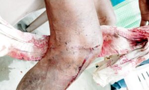Chhattisgarh Crimes
