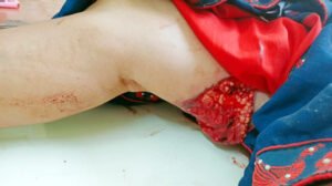 Chhattisgarh Crimes