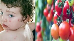 तेजी से फैलने वाले इस बुखार को क्यों कहते हैं 'टोमेटो फीवर'? ये हैं लक्षण और बचाव के उपाय Chhattisgarh Crimes