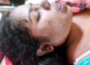 फांसी पर लटकी मिली जेल प्रहरी की पत्नी की लाश, पूरे शरीर में चोट के निशान Chhattisgarh Crimes