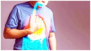 खाली पेट खट्टा खाने से लेकर गलत समय में दूध पीने तक, जानें बार बार एसिडिटी होने के 4 कारण Chhattisgarh Crimes