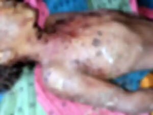 बिस्किट लेने दुकान गई 5 साल की बच्ची को आवारा कुत्तों के झुंड ने नोचा, मौत Chhattisgarh Crimes