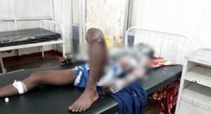 एकतरफा प्यार में प्रेमी ने युवती के घर के पास पेट्रोल डालकर खुद को लगाई आग, हालत गंभीर… Chhattisgarh Crimes