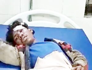 मोबाइल चोर भतीजे ने किया जानलेवा हमला, चाचा समेत 3 लोग घायल Chhattisgarh Crimes