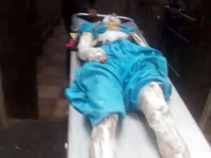 चार्ज करते वक्त फटी ई-स्कूटी की बैट्री:घर में लगी आग, गंभीर रूप से झुलसी युवती Chhattisgarh Crimes