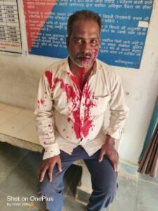 सांकरा थाना के ग्राम लोहरीन डोंगरी में सीमांकन के दौरान दो पक्षों में जमकर मारपीट Chhattisgarh Crimes