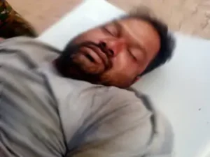 छत्तीसगढ़ के सरगुजा जिले में रविवार शाम बिजली के खंभे में चढ़कर स्ट्रीट लाइट लगाने के दौरान करंट लगने से एक युवक बुरी तरह झुलस गया Chhattisgarh Crimes