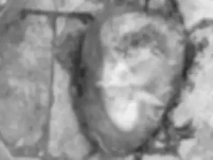 राजधानी रायपुर के भीमराव अंबेडकर अस्पताल (मेकाहारा) परिसर में एक 5 से 6 महीने का भ्रूण मिला Chhattisgarh Crimes