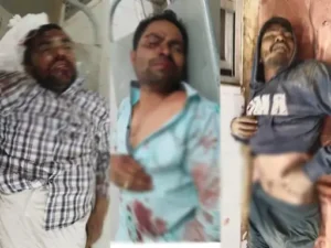 सरगुजा के नेशनल हाईवे-43 पर शांतिपारा के पास दो बाइकों की भिड़ंत में युवा भाजपा नेता समेत दो युवकों की मौत Chhattisgarh Crimes