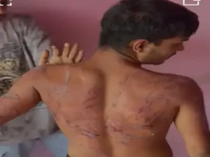 छत्तीसगढ़ की राजधानी रायपुर के पंडरी मोवा स्थित 'साहस नशामुक्ति केंद्र' से इंसानियत को शर्मसार करने वाली तस्वीर सामने आई Chhattisgarh Crimes