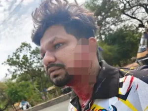 छत्तीसगढ़ के दुर्ग जिले में मोहर्रम की तैयारियों के दौरान कमेटी के सदस्यों के बीच विवाद हिंसक हो गया Chhattisgarh Crimes
