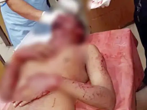 छत्तीसगढ़ के रायगढ़ में देर रात गुटखा खाने जा रहे एक युवक का कुछ युवकों ने रास्ता रोक लिया Chhattisgarh Crimes