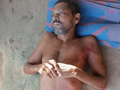 सूरजपुर जिले के रामानुजनगर वन परिक्षेत्र के चुकननाखा जंगल में एक ग्रामीण पर भालू ने हमला कर दिया Chhattisgarh Crimes