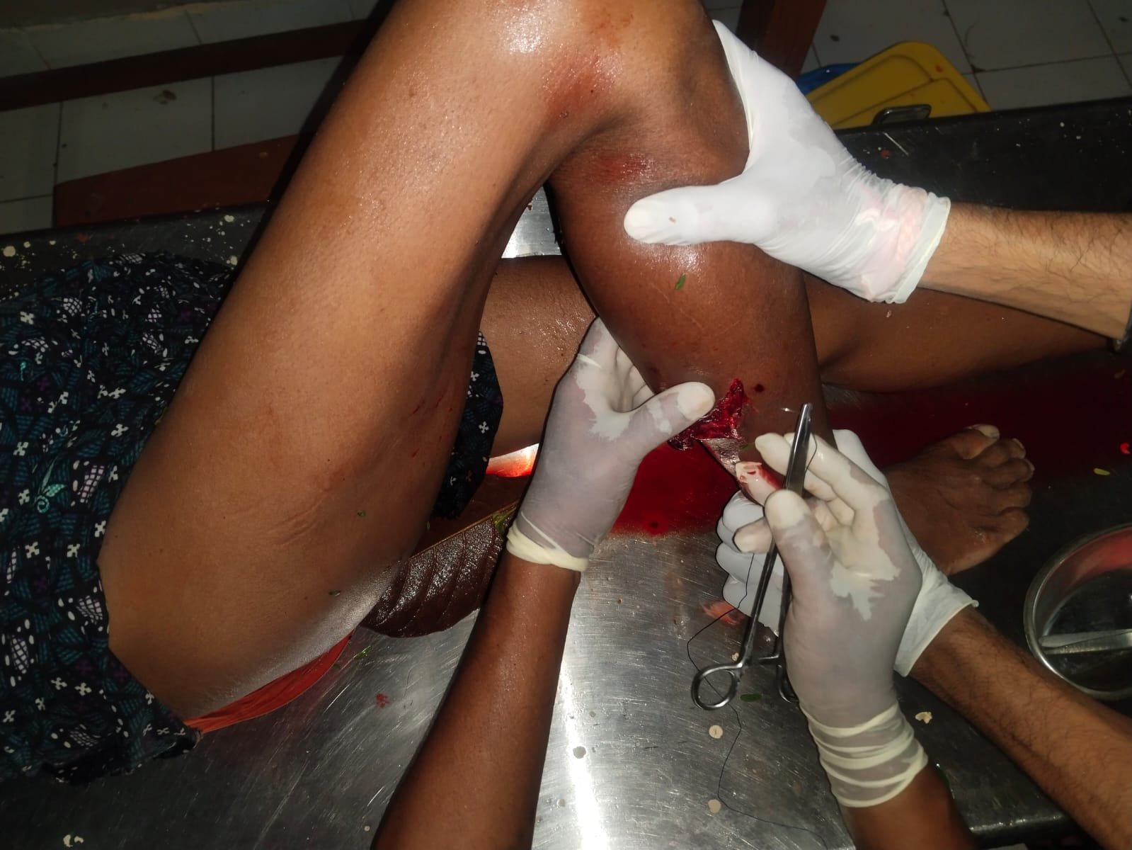 Chhattisgarh Crimes